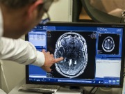 A researcher points to a brain scan