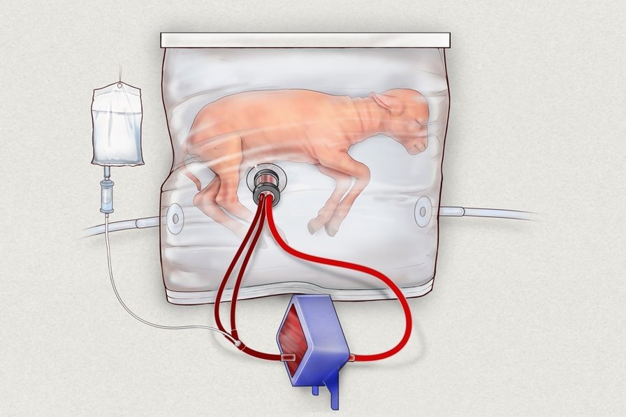 Artificial womb breakthrough stirs medical community